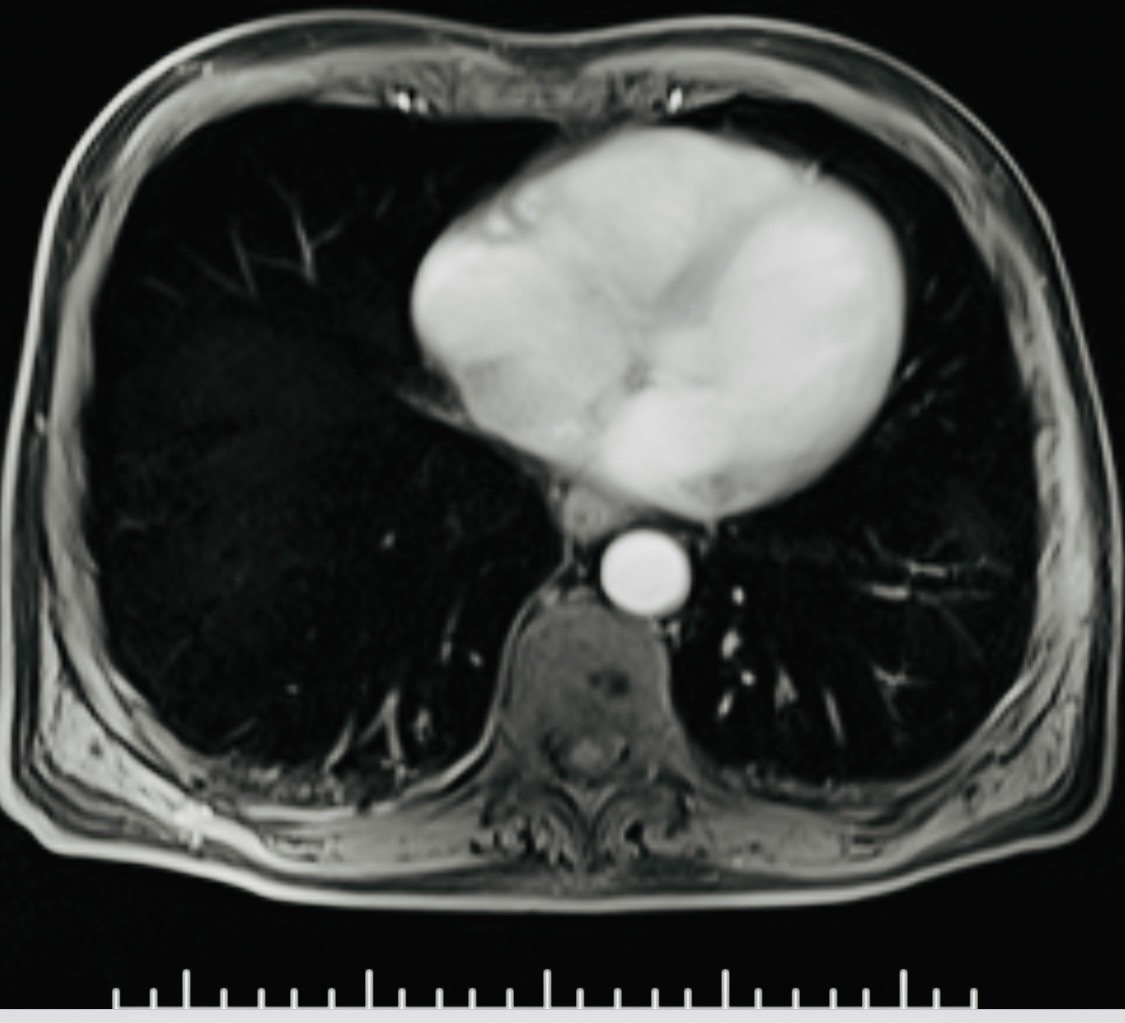 Cross-sectional imaging example used to illustrate staging assessment